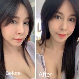 00036600